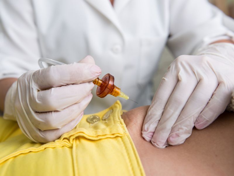 Lee más sobre el artículo ¿Cómo se realiza una sesión de carboxiterapia? Descubre todo sobre el procedimiento